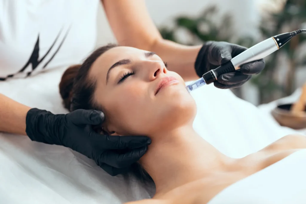 Microneedling Treatment in Ashburn, VA - Invigue Medspa