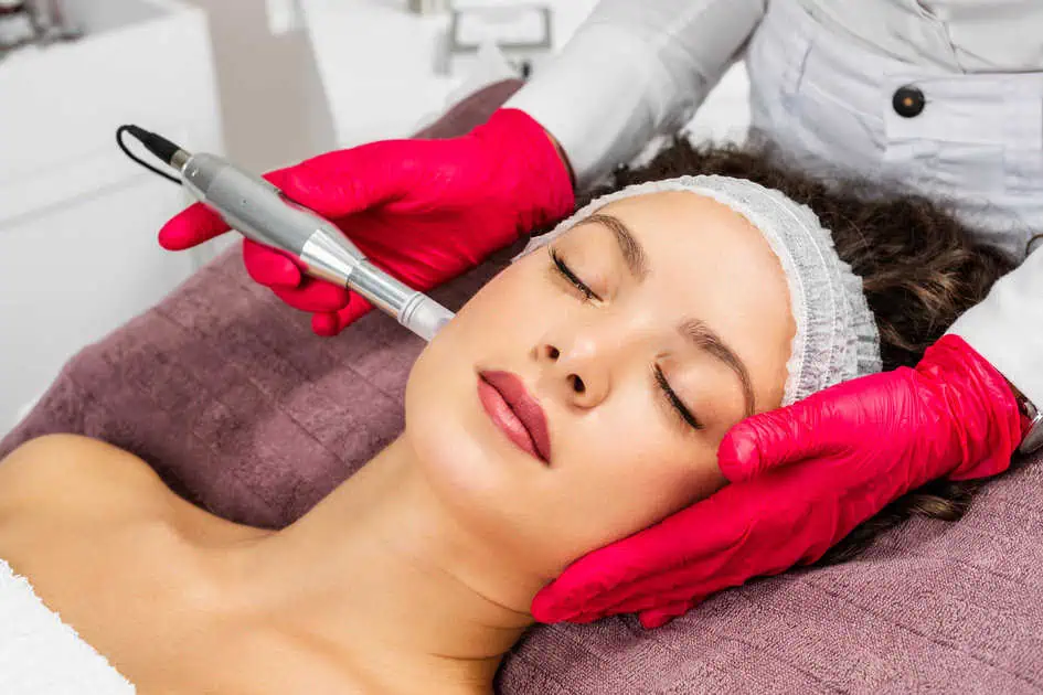 Microneedling by Invigue Medical Aesthetics and Wellness in Ashburn VA