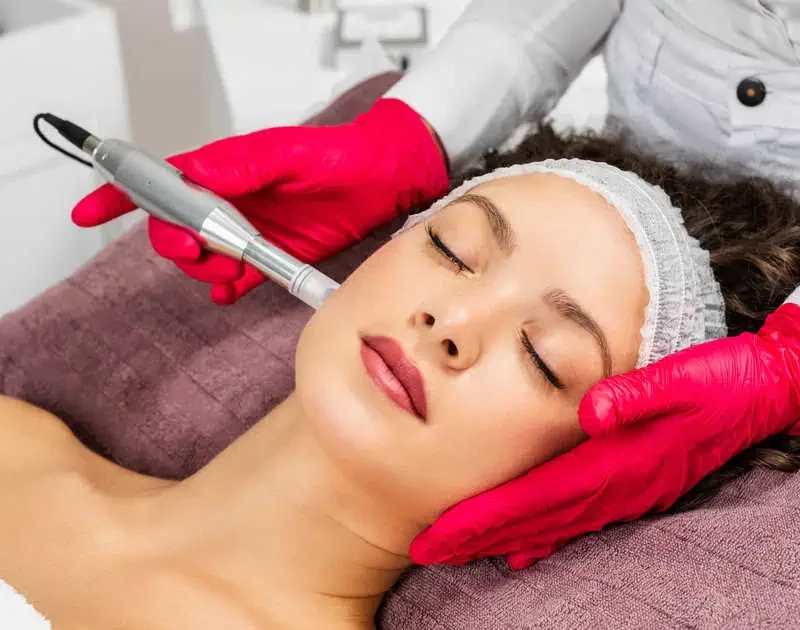 Microneedling by Invigue Medical Aesthetics and Wellness in Ashburn VA