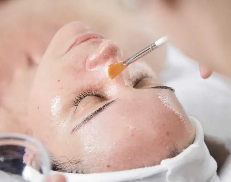 Chemical Peel in Ashburn by Invigue Medical Aesthetics and Wellness
