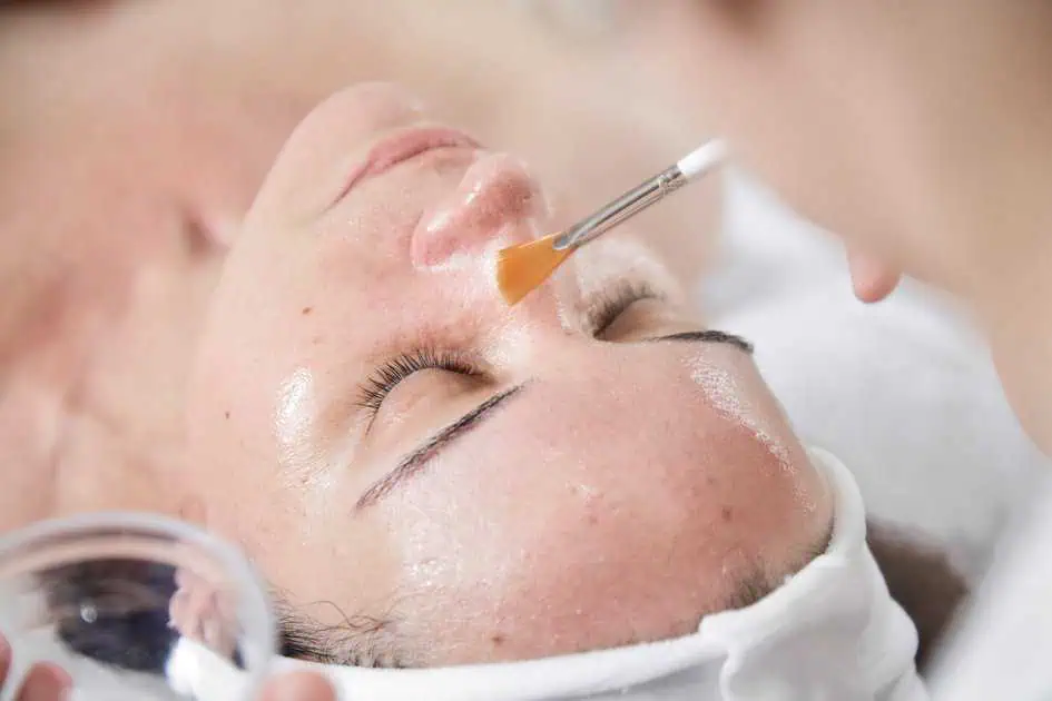 The Science Behind Chemical Peels: Transforming Your Skin with Advanced Dermatology