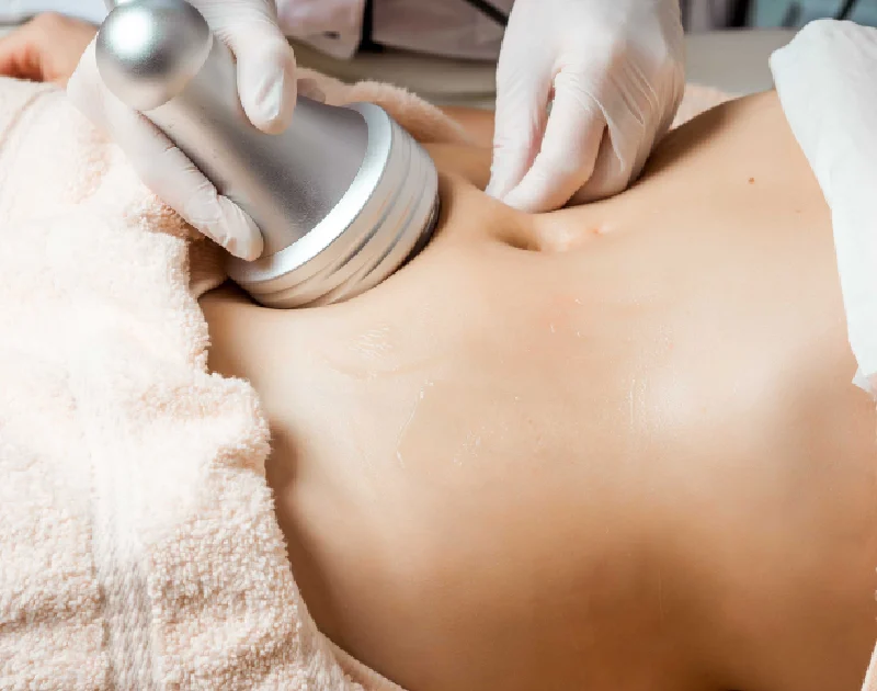 A close-up of a person receiving a non-invasive body contouring treatment on the abdomen in Ashburn, VA