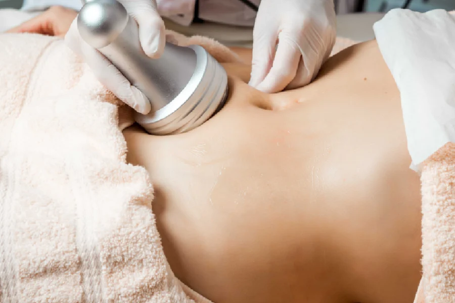 A close-up of a person receiving a non-invasive body contouring treatment on the abdomen in Ashburn, VA