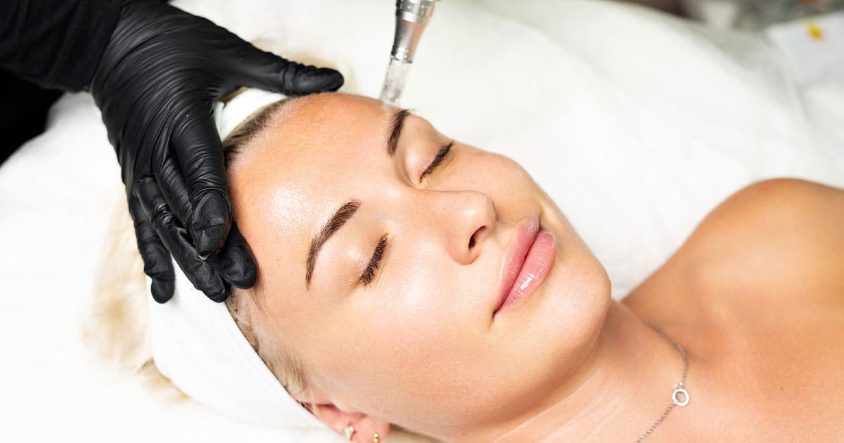 woman getting skinpen microneedling in Ashburn, VA
