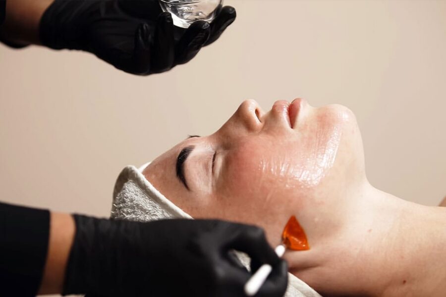 woman getting a chemical peel in Ashburn, VA