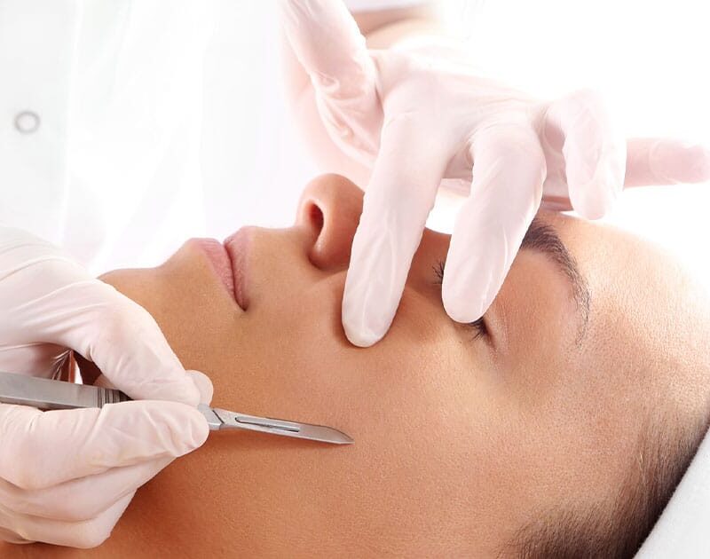 woman getting dermaplaning in Ashburn, VA