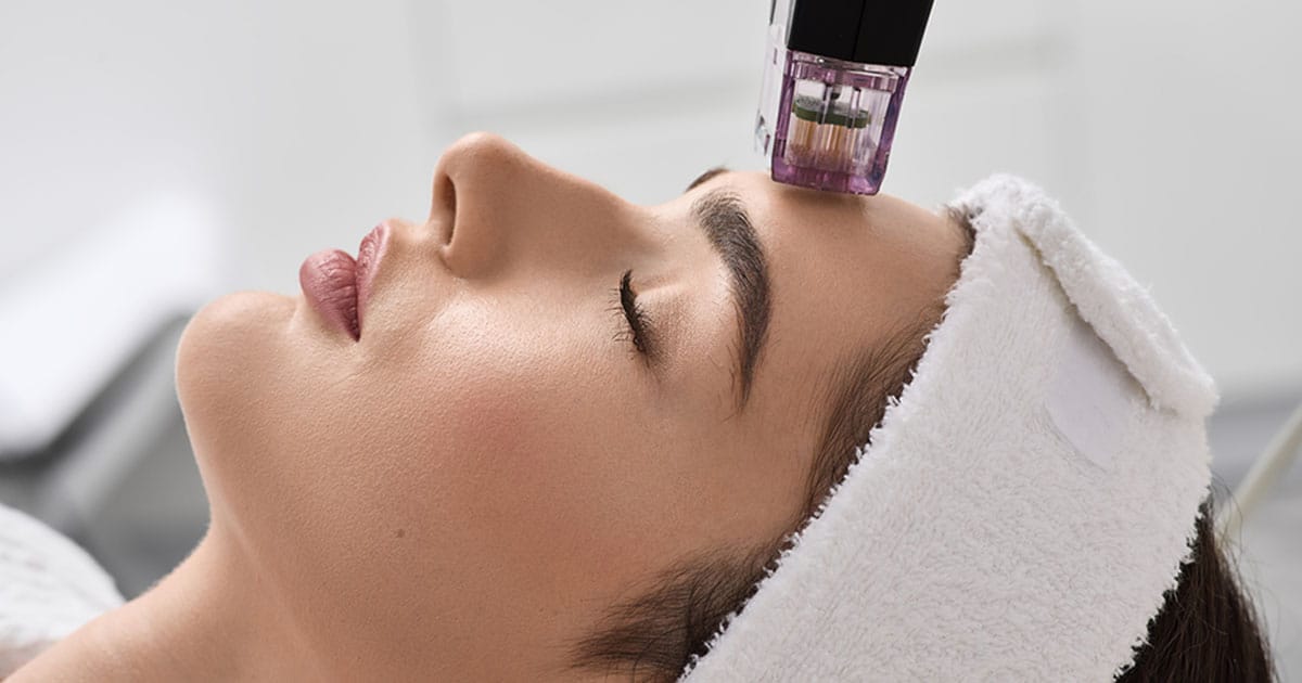 woman getting microneedling in Ashburn, VA
